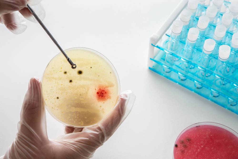 Overview of Method Validation for Microbiology